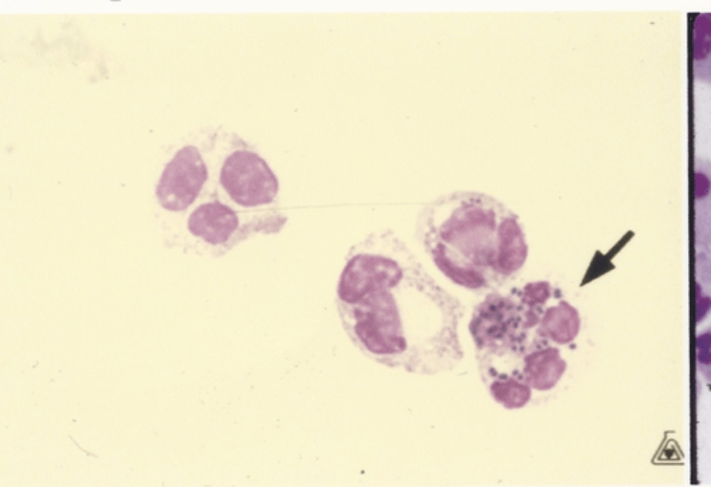<p>Identify the cells in this body fluid</p>