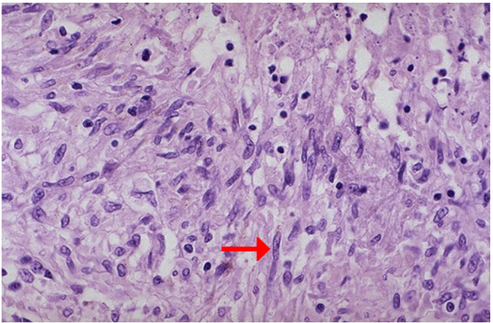 <ol><li><p>Identify</p></li><li><p><span>What cells are pointed?</span></p></li><li><p><span>What bone marrow-derived cell can become this cell?</span></p></li></ol><p></p>