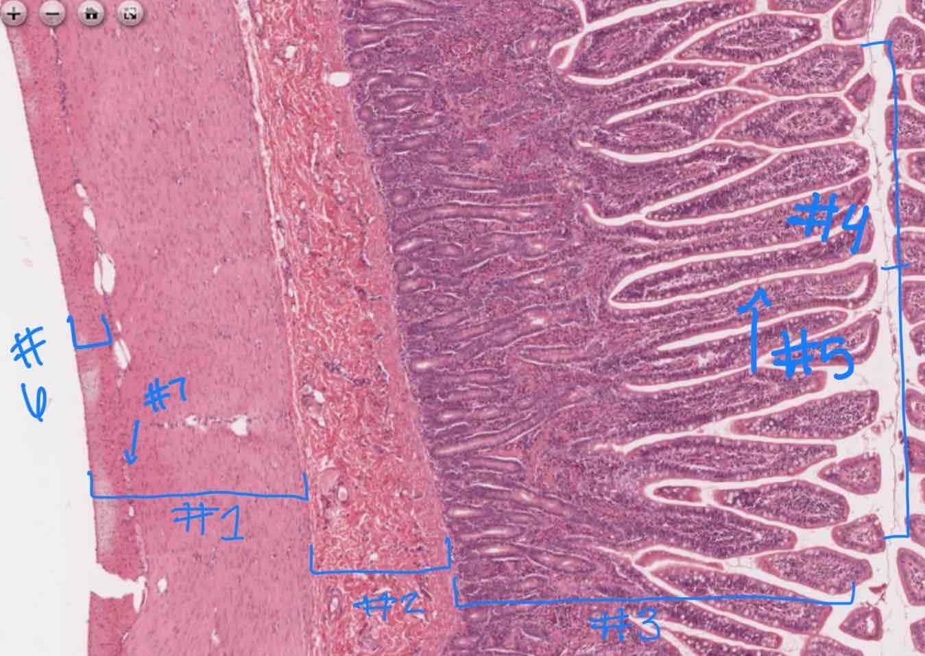 <p>What major layer is indicated by #4?</p>