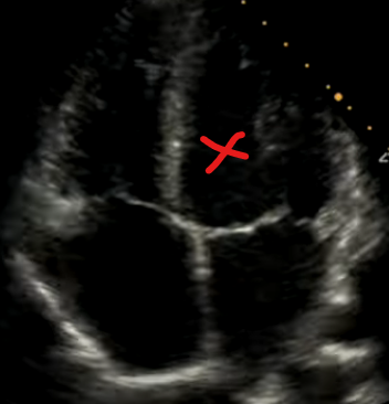 <p>What is X</p>