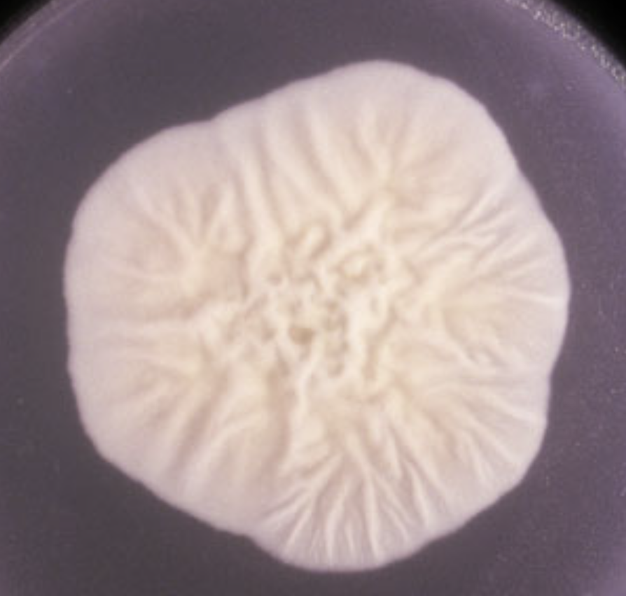 <p>What organism is this? Obverse or reverse?</p>