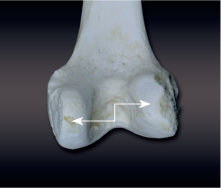 <p>rounded process covered with hyaline on its ends and articulates with another bone</p>