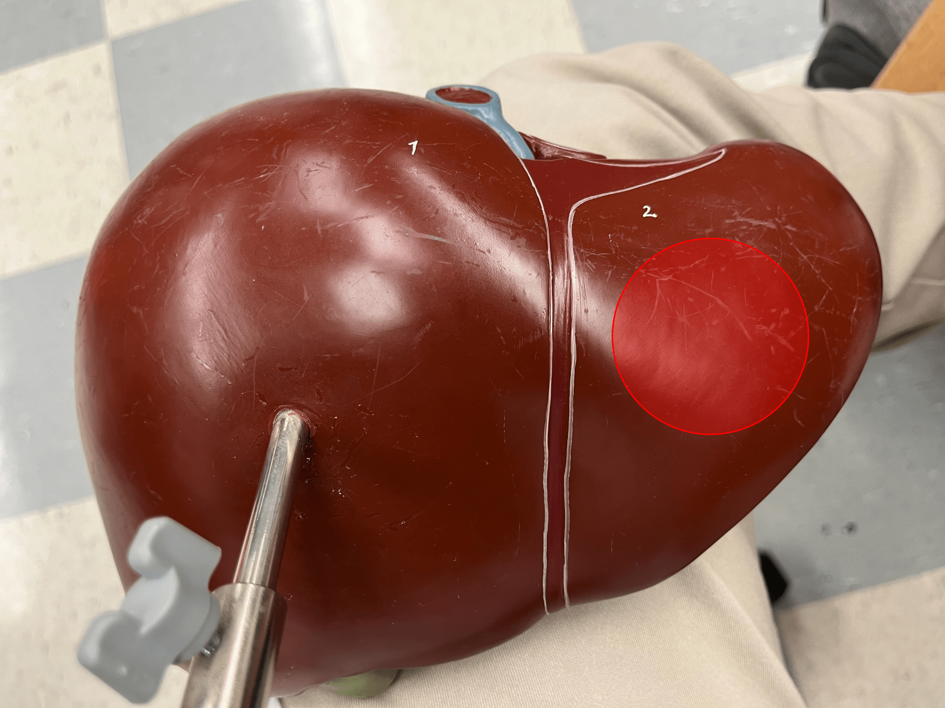 • A lobe of the liver.

• The smaller lobe on the anterior of the liver.