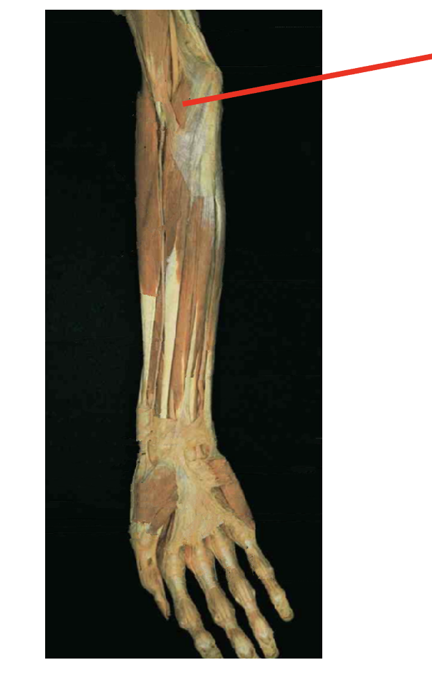 <p>What is this muscle? where does it insert? where is its origin</p>