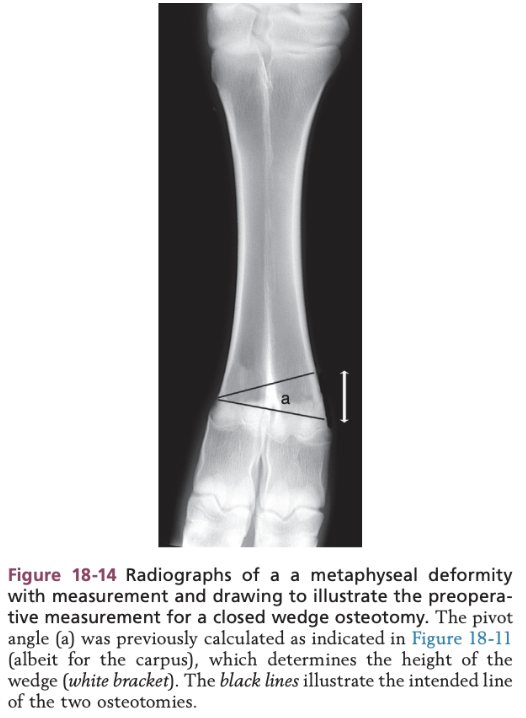 <ul><li><p><span>Line is drawn parallel to the joint at the level of the pivot point</span></p></li><li><p><span>Height of the second osteotomy site is calculated by using the angle of deviation at the pivot point</span></p></li></ul>