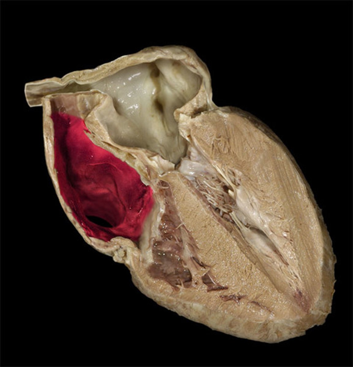 <p>What chamber of the heart is highlighted in red?</p>