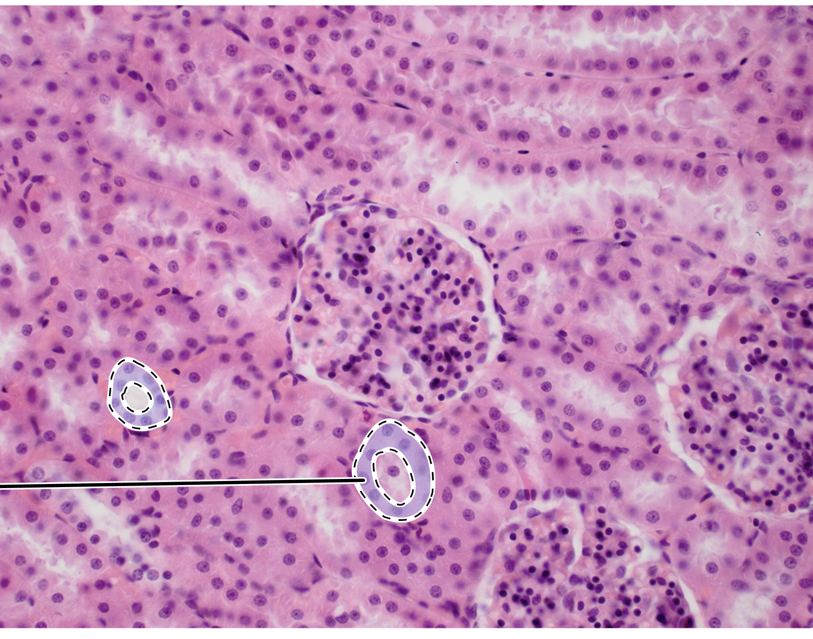 <p>Name the highlighted tissue.</p>