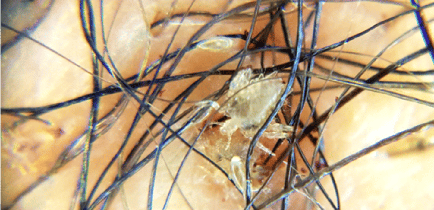 <p>cause pediculosis or infestation with lice</p>