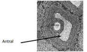 <ul><li><p>Surrounded by several layers of follicular cells.</p></li><li><p>Differentiation in cell layers</p><ul><li><p>Granulosal cells- inner most cells, surround oocyte.</p></li><li><p>Thecal cells surround granulosal cells.</p></li></ul></li><li><p>Follicle forms a fluid filled cavity- antrum.</p></li><li><p>Has the potential to rupture and ovulate</p></li></ul>