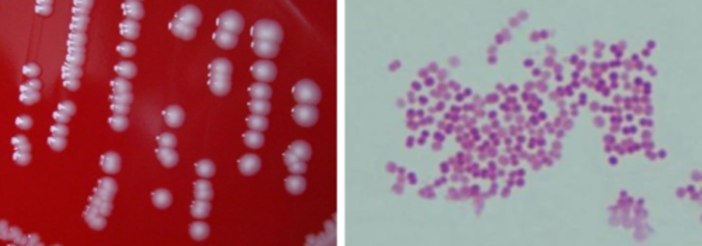 <p>-Growth on blood, chocolate</p><p>-Does NOT grow on MacConkey</p><p>-Colony moves like hockey puck</p>