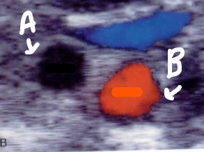 <p>Identify this image. </p>