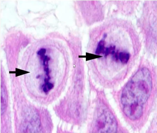 <p>Identify the stage of mitosis</p>