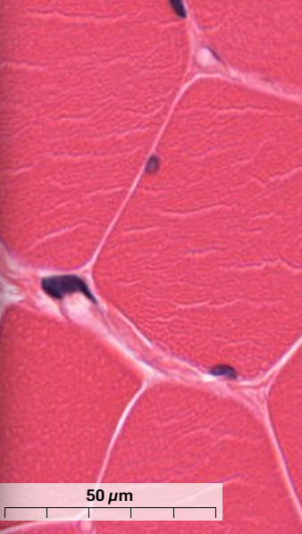 <p>What are the white-line structures shown in the skeletal muscle?</p>