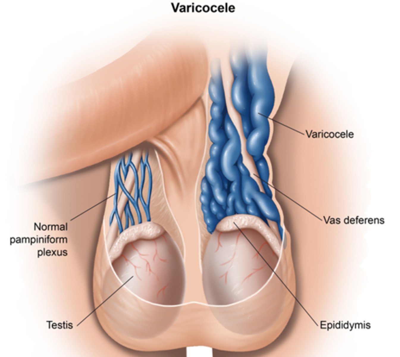 <p>Order a renal ultrasound - Britt has seen renal cell carcinoma missed because people did not do this!!!</p>