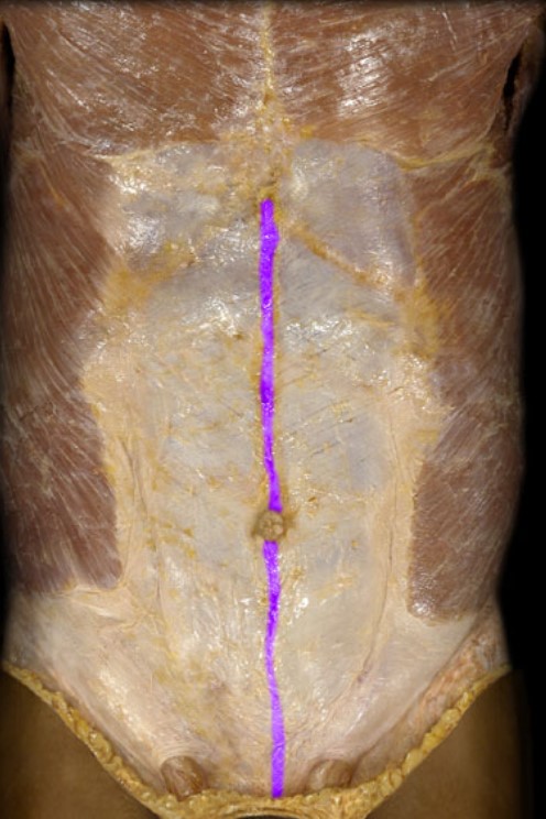 <p>Name the muscle highlighted (two words - all lowercase)</p>