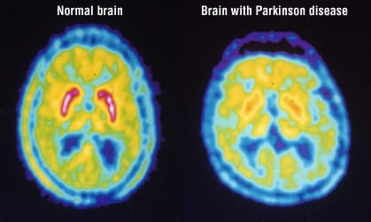 <p>What method of studying the brain is this?&nbsp;</p>