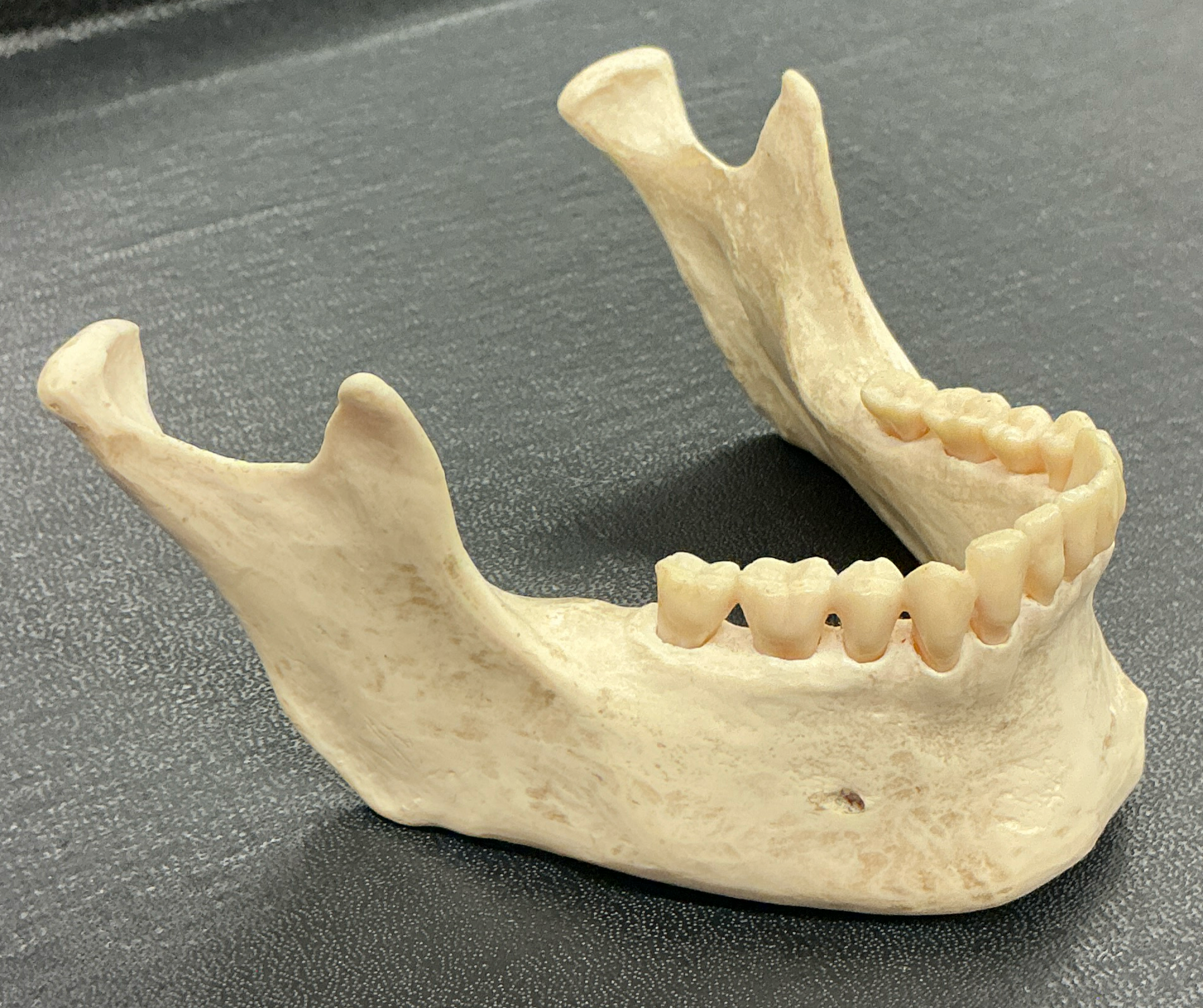 <p>What is the name of this bone?</p>