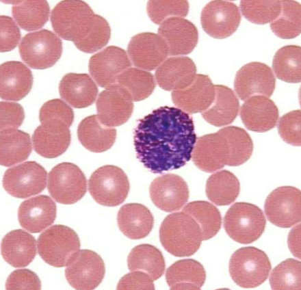 <p>dark purple granules making nucleus and cytoplasm hard to see, same size as erythrocytes</p>