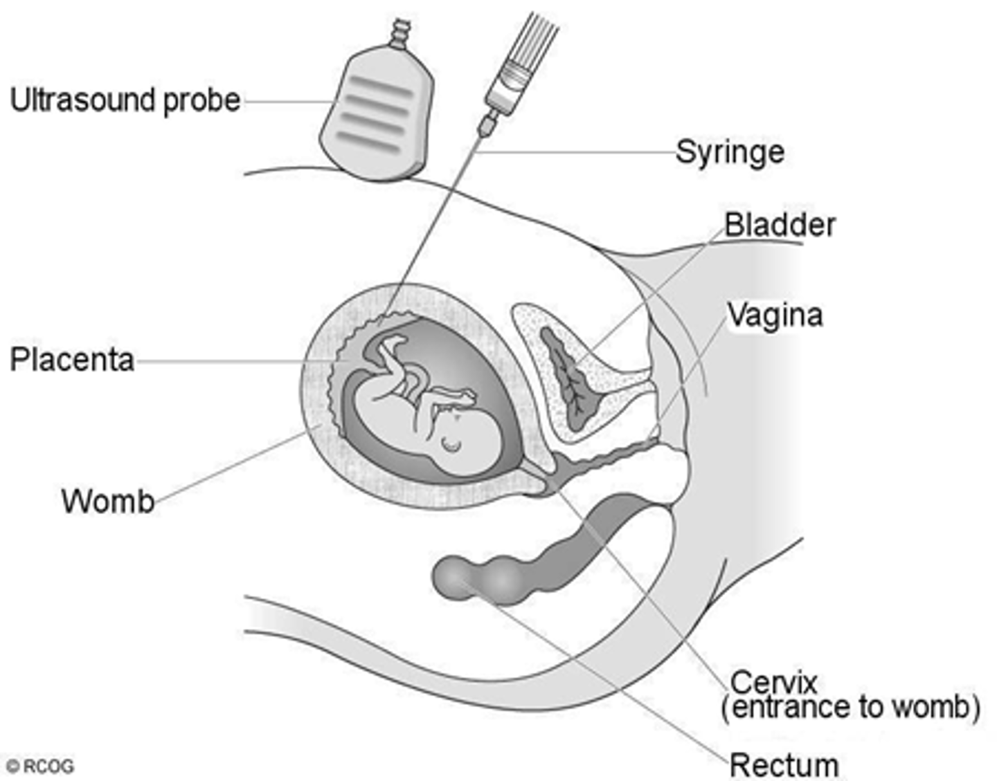 <p>Tests to see if embryo has genetic abnormalities, defects, or anomalies</p>