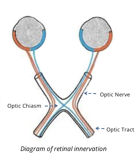 <ul><li><p><span style="font-family: Calibri">Visual processing is not as simple as receiving the information from an eye. We have two eyes that are set apart, and because they are set apart, they receive different visual input and send different information to the brain.</span></p></li><li><p><span style="font-family: Calibri">Having two eyes improves depth perception, which is lost if a person loses their sigh in one eye</span></p></li></ul>