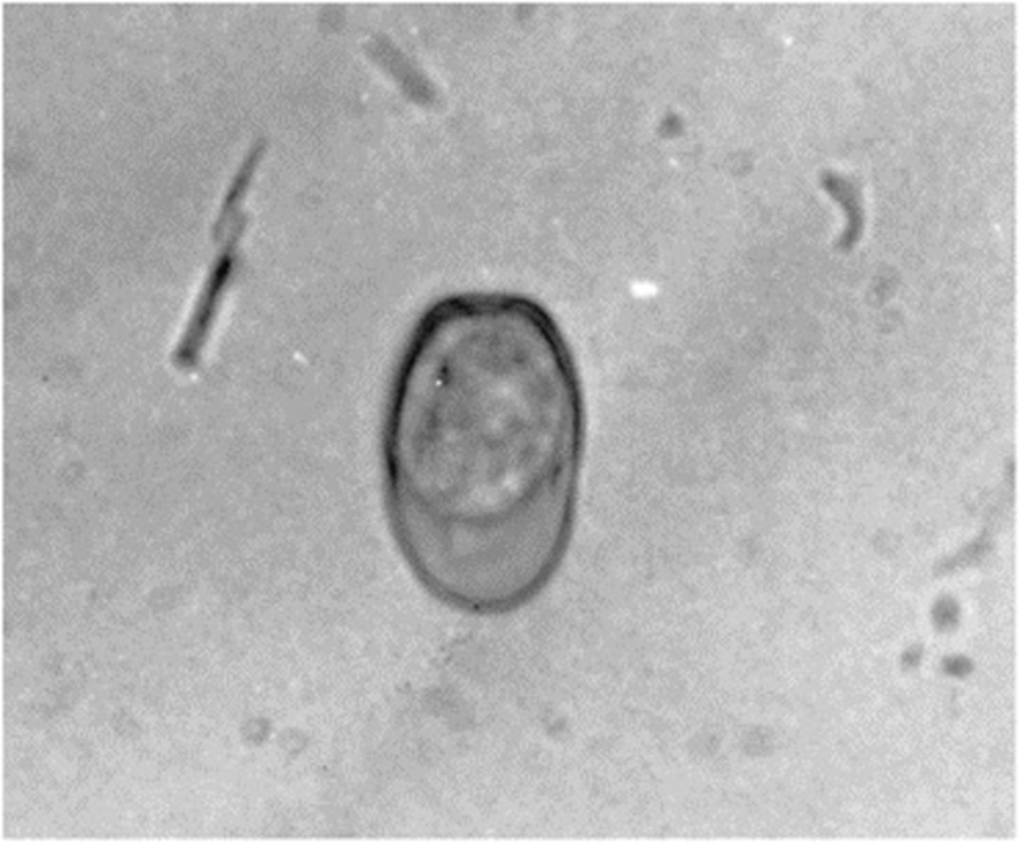 <p>Identify this protozoan parasite of rabbits. It has a micropyle at one end of the oocyst.</p>
