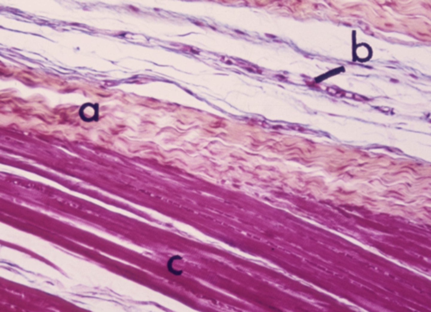 <p>What connective tissue type is labeled "a"?</p>