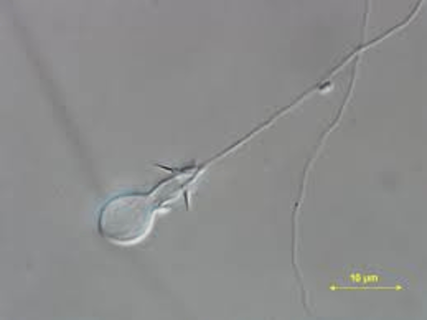 <p>Cells with filaments that can penetrate and inject venom into predators or prey</p>