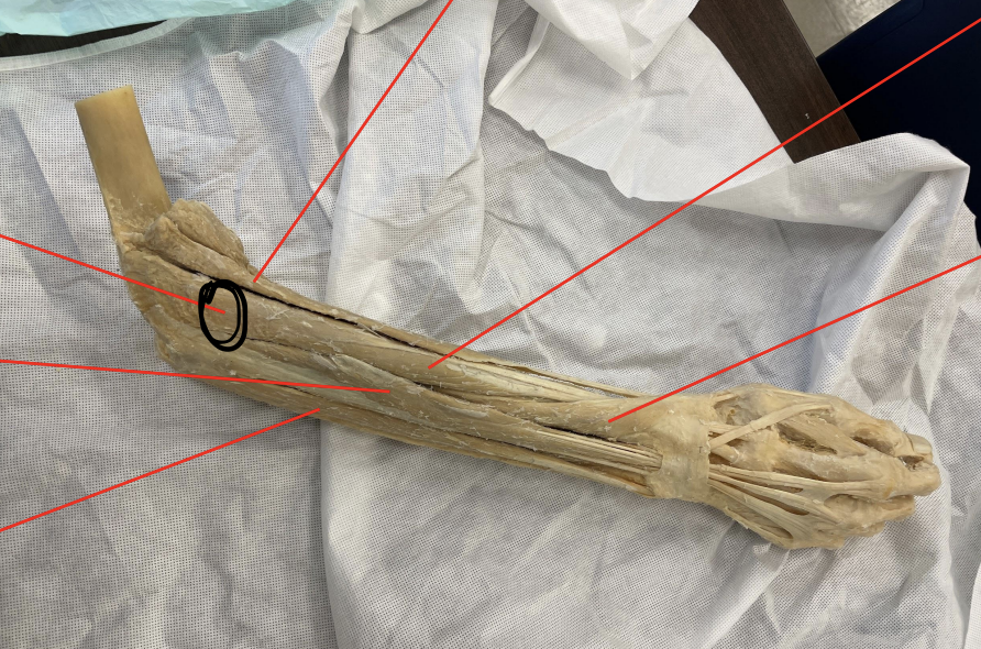 <p>identify + state origin, insertion, action, innervation of marked structure</p>