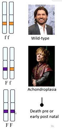 <p>Example = achondroplasia</p>