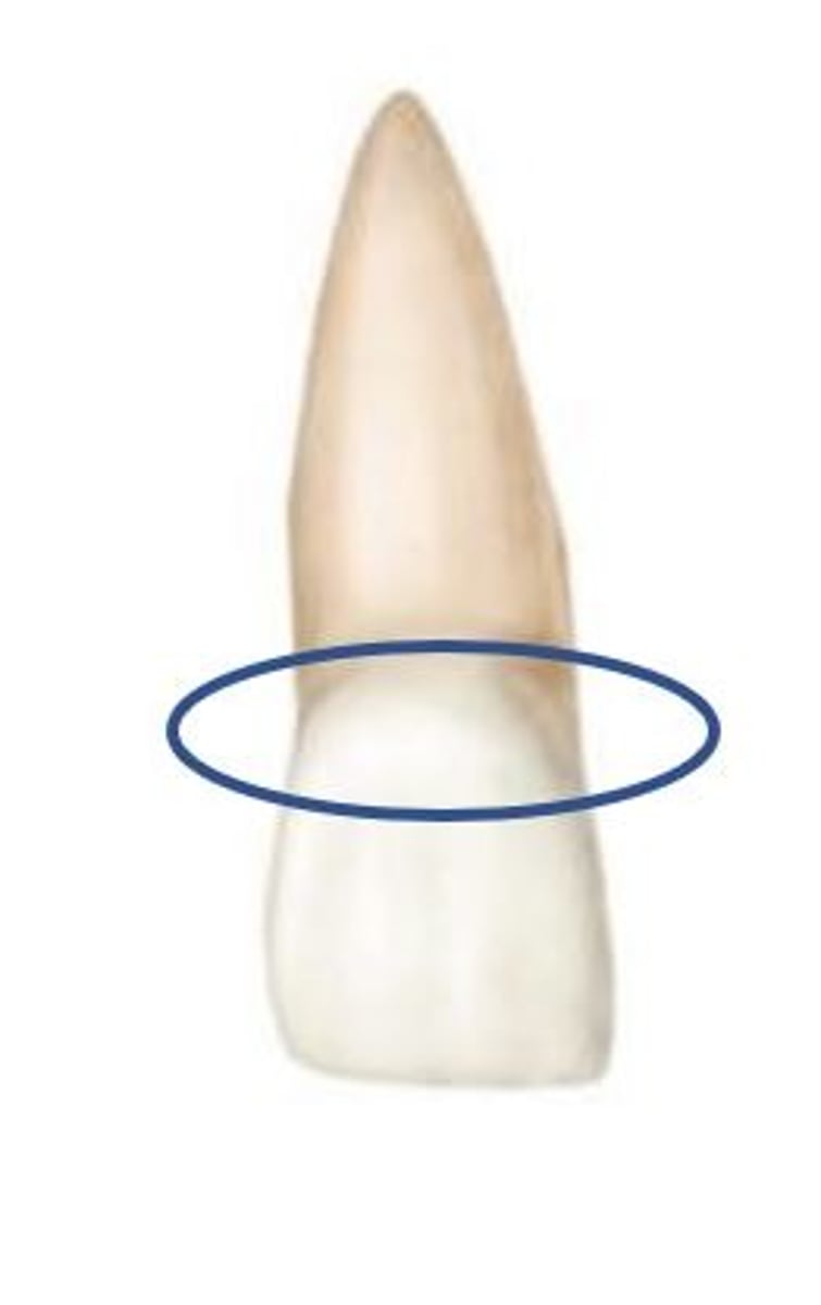<p>What part of the tooth crown is this?</p>