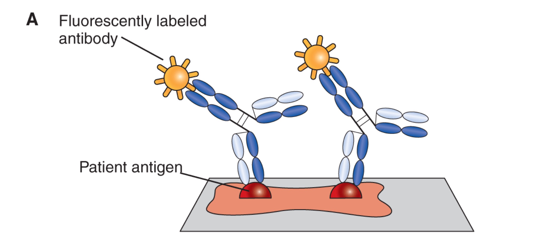 <p>Fluorescent immunoassay</p>