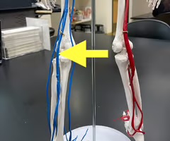<p>Name the blood vessel.</p>
