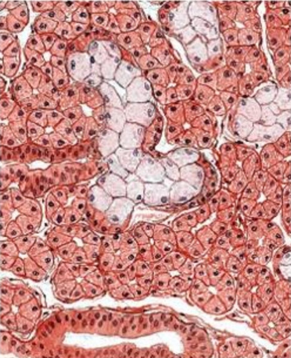 <p>what gland is this from? how do you know?</p>