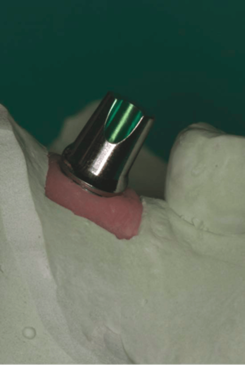 <p>ID the part:</p>