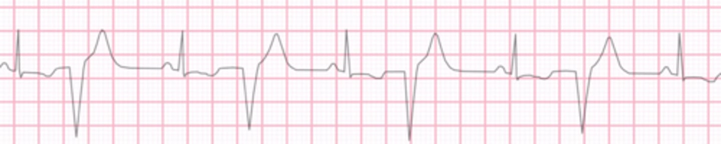 <p>Name the rhythm</p>