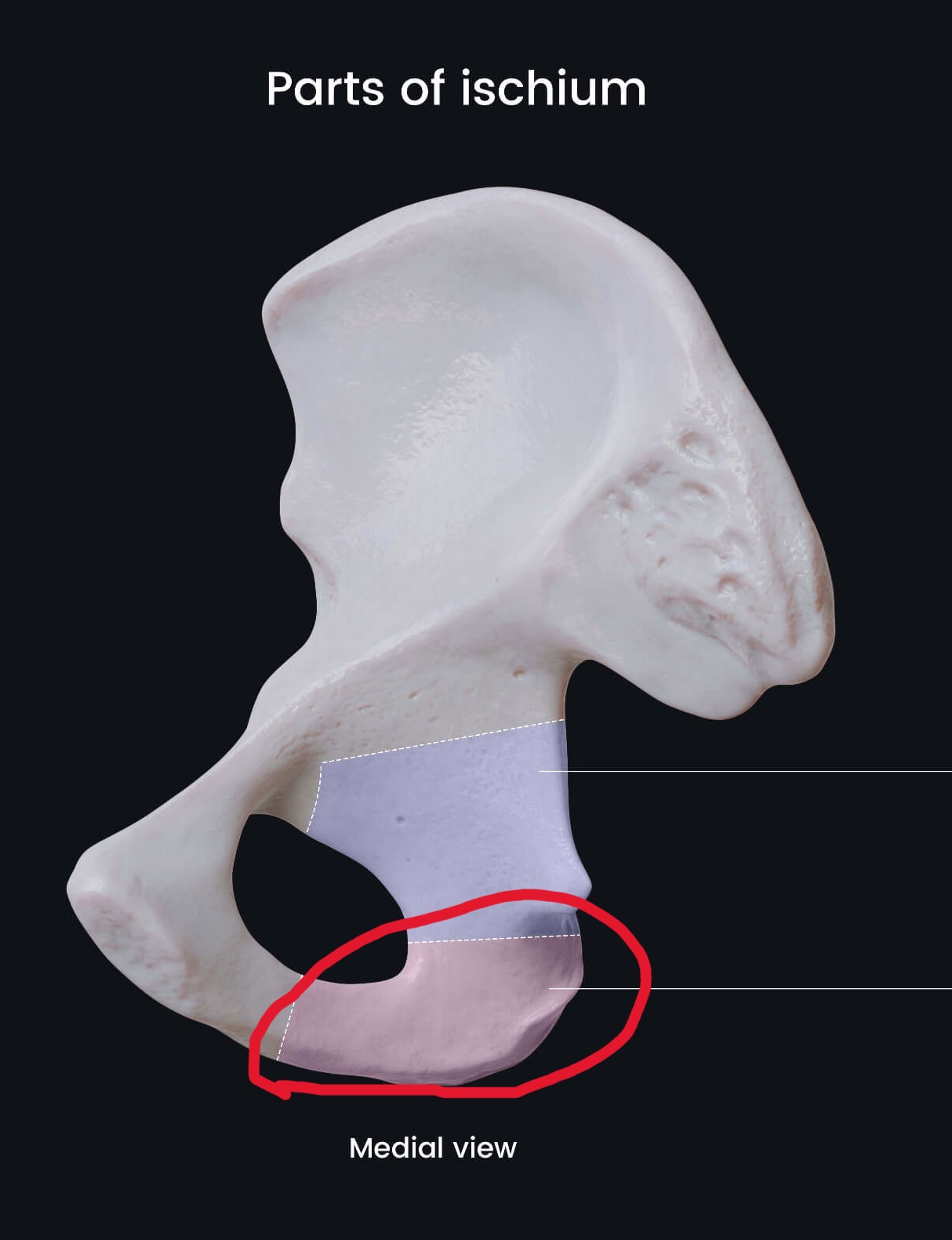term image