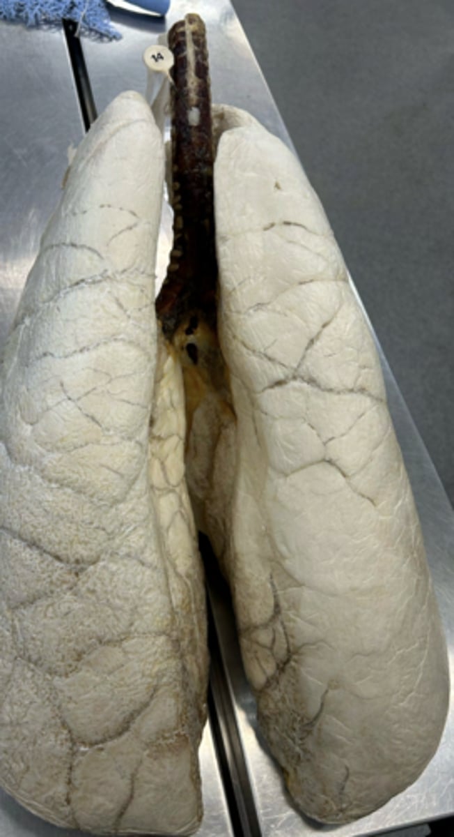 <p>From what domestic animal is this lung from?</p>