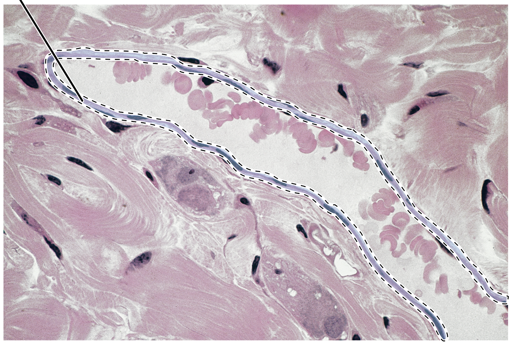<p>Name the highlighted tissue.</p>