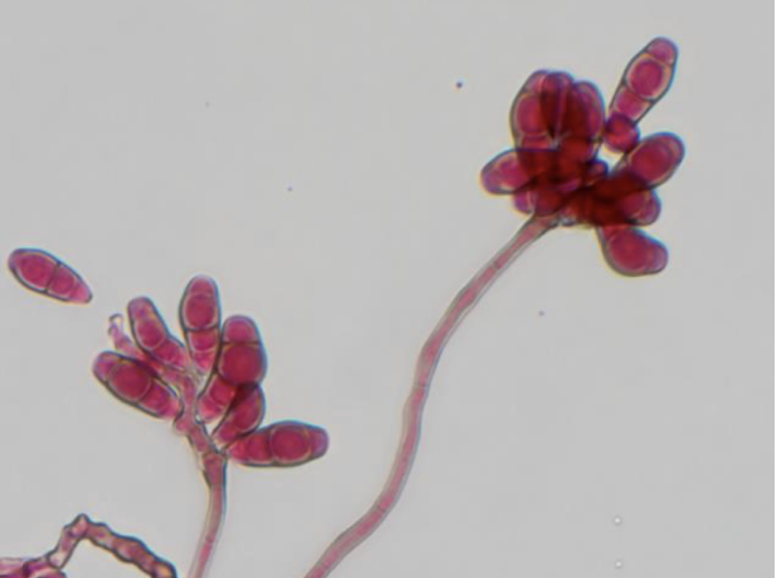 <p>Curvularia lunata</p>