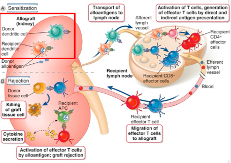 <p>In the case of direct allorecognition, donor dendritic cells in the allograft migrate to secondary lymphoid tissues, where they directly present allogeneic major histocompatibility complex <em>(MHC) </em>molecules to host T cells. Only CD8+ T cells recognizing donor class I MHC is shown, but CD4+ T cells can also directly recognize donor class II MHC.</p><p>In the case of indirect allorecognition, recipient dendritic cells that have entered the allograft, transport donor MHC proteins to secondary lymphoid tissues and present peptides derived from these MHC proteins to alloreactive host T cells.</p><p>This is shown for CD4+ T cells, and indirect recognition of allogeneic MHC by CD8+ T cells is likely less important. After both indirect and direct allorecognition, the T cells become activated and differentiate into effector CD4+ helper T cells and CD8+ cytotoxic T lymphocytes (CTLs).</p><p>The alloreactive effector T cells migrate into the allograft, become reactivated by alloantigen, and mediate damage. In the graft, direct recognition of allogeneic class I MHC by CD8+ CTLs is required for killing of graft parenchymal cells, because these cells express only allogeneic MHC.</p><p>In contrast, CD4+ helper T cells that can directly or indirectly recognize allogeneic class II MHC can be activated by donor or host antigen-presenting cells <em>(APCs), </em>respectively, and both can promote inflammation that damages the graft</p>