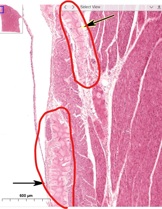 <p>subendocardial/Purkinje fibers</p><p>notice how they are much longer than the surrounding cardiac cells</p><p>notice how they are lighter in color</p>