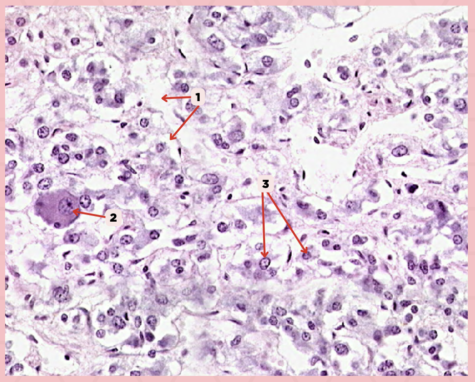 <p>Which cells in the adrenal medulla are responsible for secreting catecholamines and exhibit a chromaffin reaction when treated with chromate?</p>