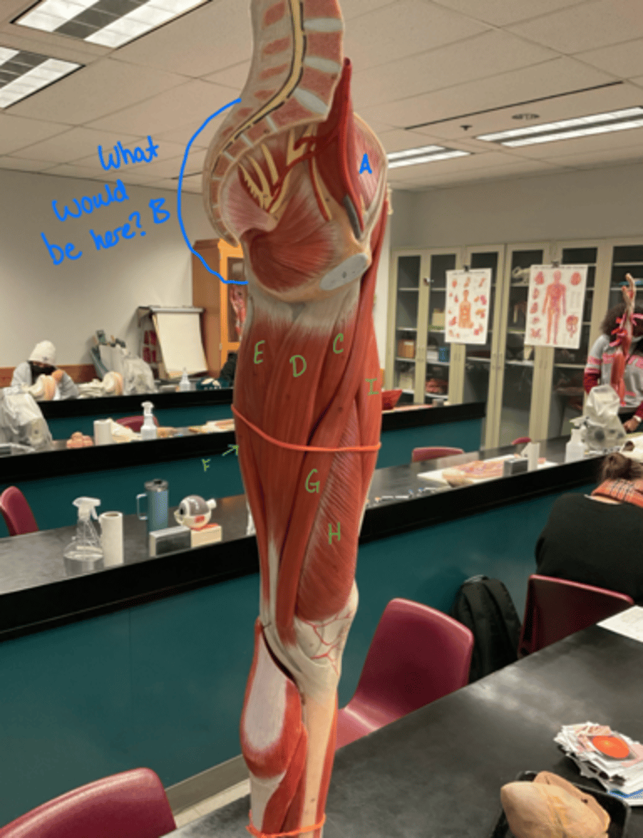 <p>gluteus maximus</p>