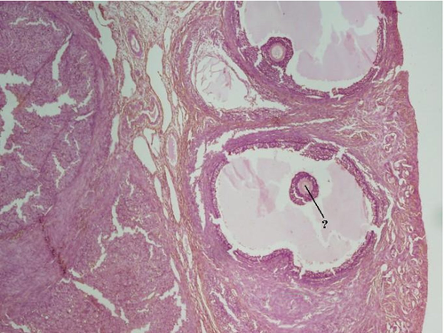 <p>Identify the indicated structure within the ovary.</p>