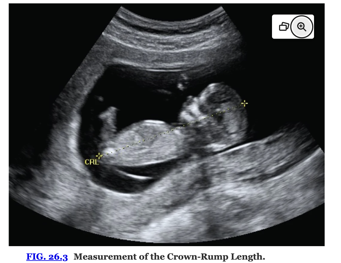 <ul><li><p>indicated for situations such as uncertainty regarding the date of the last normal menstrual period, recent discontinuation of oral contraceptives, a bleeding episode during the first trimester, uterine size that does not correlate with dates, and other high-risk conditions</p></li><li><p>Either the <u>maximum embryo length or the crown-rump length</u> is used during the <strong>first trimester</strong> to measure the early embryo</p></li><li><p>After the first trimester, the <mark data-color="yellow" style="background-color: yellow; color: inherit;">biparietal diameter (BPD), head circumference, abdominal circumference, and femur length</mark> are measured instead.</p></li></ul><p></p>