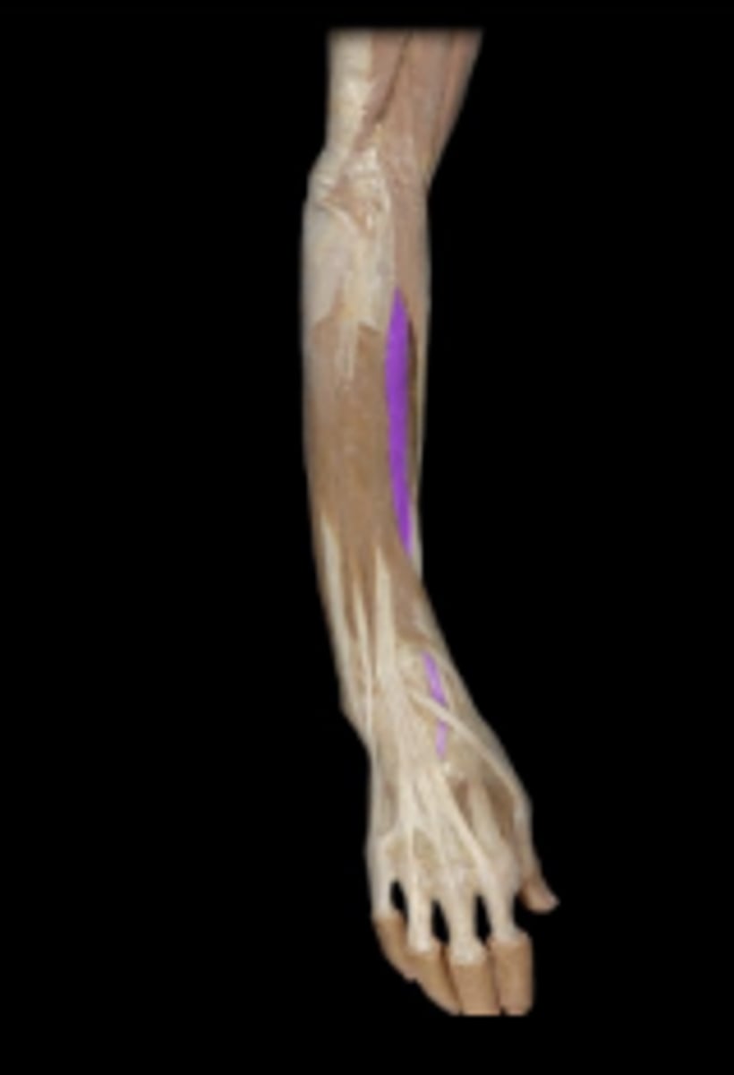 <p>action: extends wrist</p>