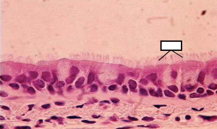 <p>Ciliated Cells Monkey Bronchus</p>