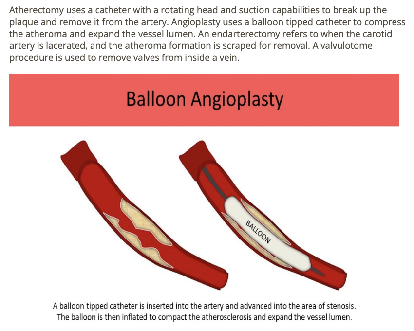<p>b) angioplasty </p>