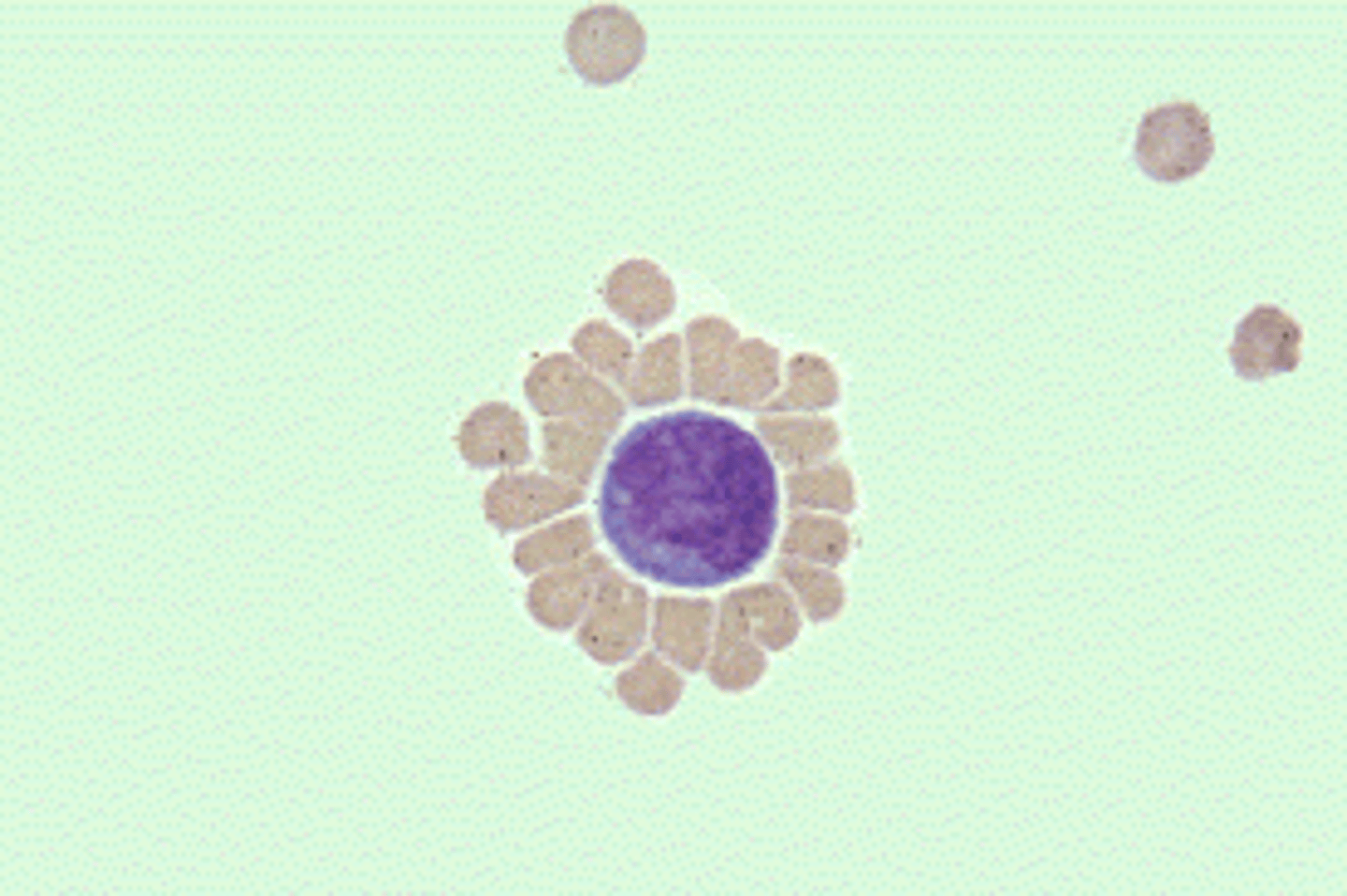 <p>What is the best description of the phenomenon seen in this illustration?</p><p>A. Rouleau formation</p><p>B. Cold agglutination</p><p>C. Rosette formation</p><p>D. Monocyte activation</p>