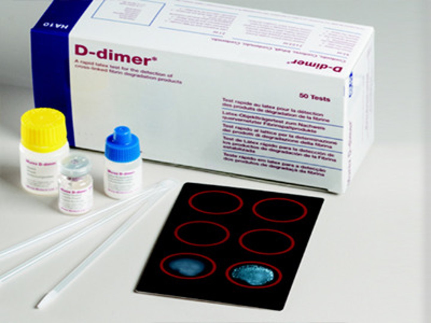 <p>Fibrin degradation product, indicative of DVT</p><p>- Fibrin degradation product: substances that remain in your bloodstream after your body dissolves a blood clot</p><p>- DVT: Deep vein thrombosis is a serious condition that occurs when a blood clot forms in a vein located deep inside your body.</p>
